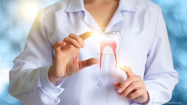 Wurzelbehandlung zur Rettung geschädigter Zähne