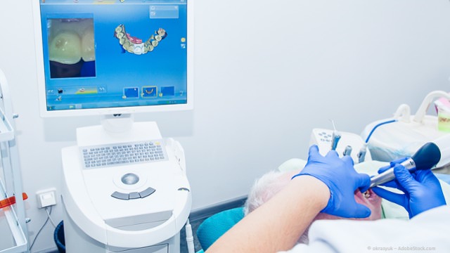 CEREC: Zahnkronen und Zahnbrücken aus reiner Keramik in einem Termin