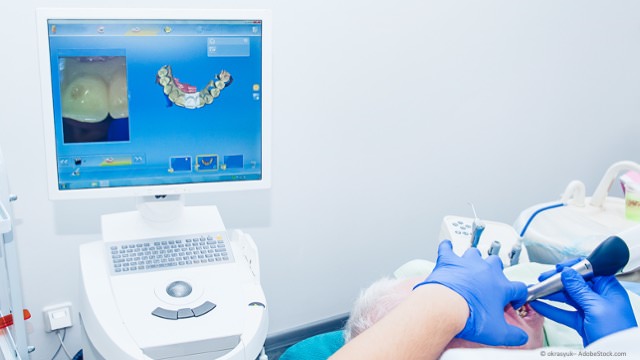 CEREC: Inlays + Zahnersatz aus Keramik in einem Termin